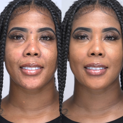 Soft matte concealer covering dark circles under eyes and hyperpigmentation